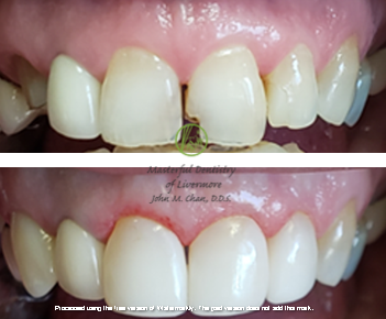 Bioclear case 8 — contour refinement